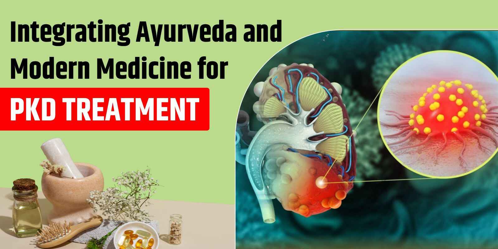 Integrating Ayurveda and Modern Medicine for PKD Treatment